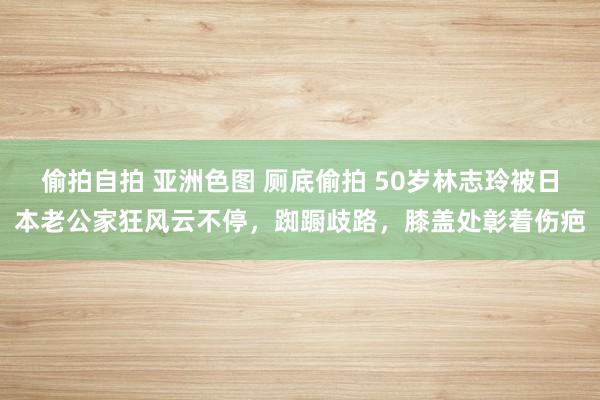 偷拍自拍 亚洲色图 厕底偷拍 50岁林志玲被日本老公家狂风云不停，踟蹰歧路，膝盖处彰着伤疤